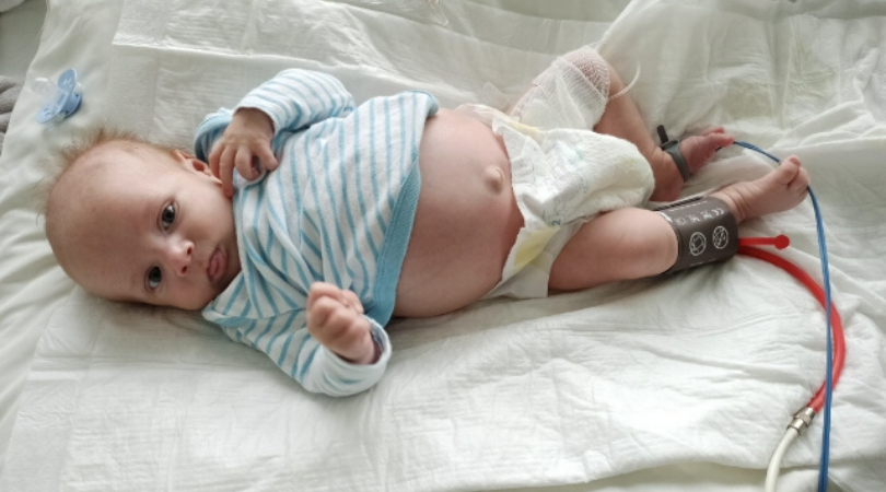 Wzdęcia? Nie. Przyczyną powiększonego brzuszka Wojtusia jest olbrzymi guz – neuroblastoma IV stopnia
